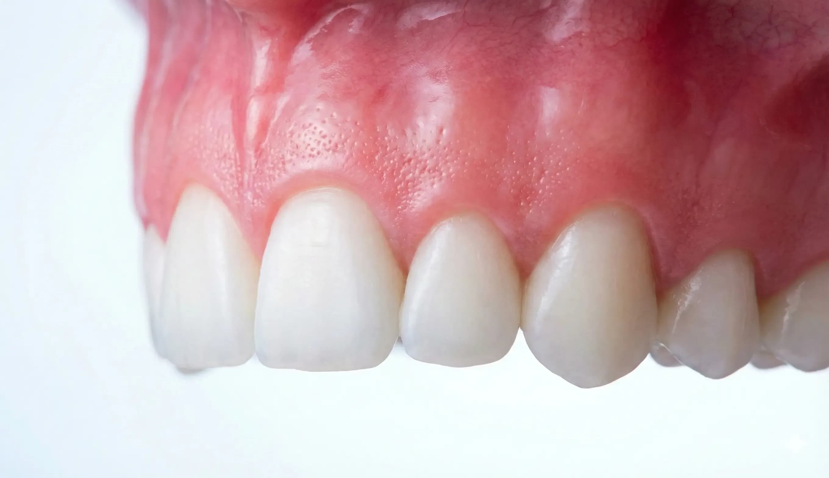 Periodontoloji (Diş Eti Hastalıkları) - Mercan Diş Ereğli